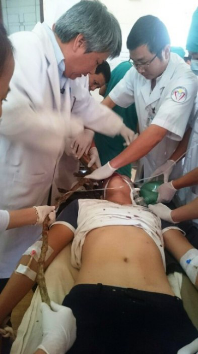 Bảo Lâm: Phẫu thuật lấy được cành cà phê ra khỏi mắt nam sinh lớp 10