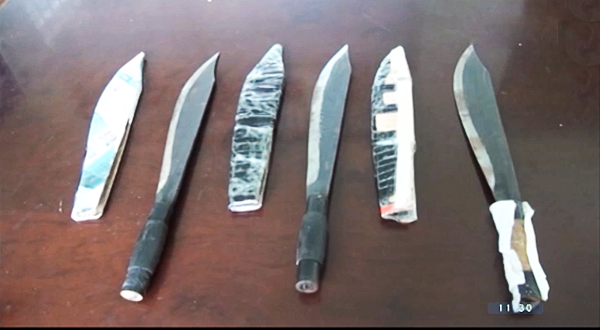 Bảo Lộc: Đang đứng trước cửa nhà, bị 6 côn đồ chém đứt gân tay