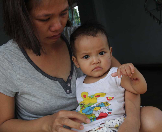 Bảo Lộc: Bé gái 7 tháng tuổi thương tích đầy mình sau 1 ngày ở nhà trẻ