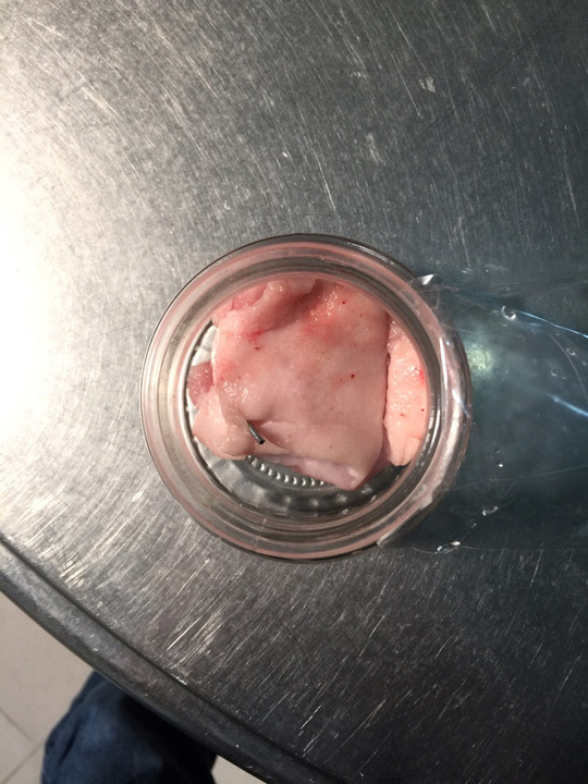 Đà Lạt: Hoảng hồn phát hiện kim tiêm trong thịt heo