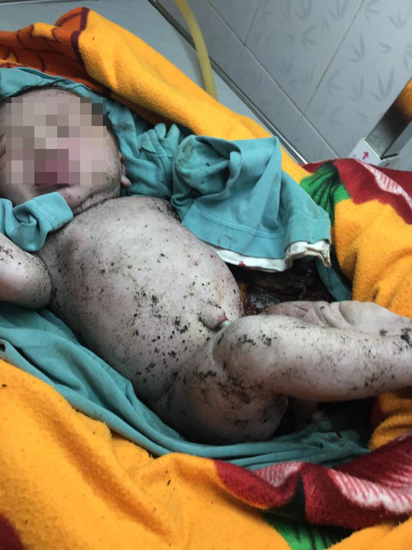 Lâm Đồng: Phát hiện bé trai còn nguyên dây rốn trong hố rác