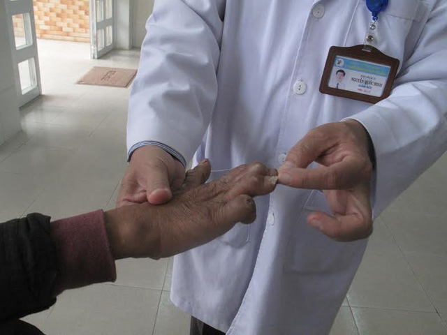 Đà Lạt: Phát hiện người lang thang mắc bệnh phong tổn thương nặng