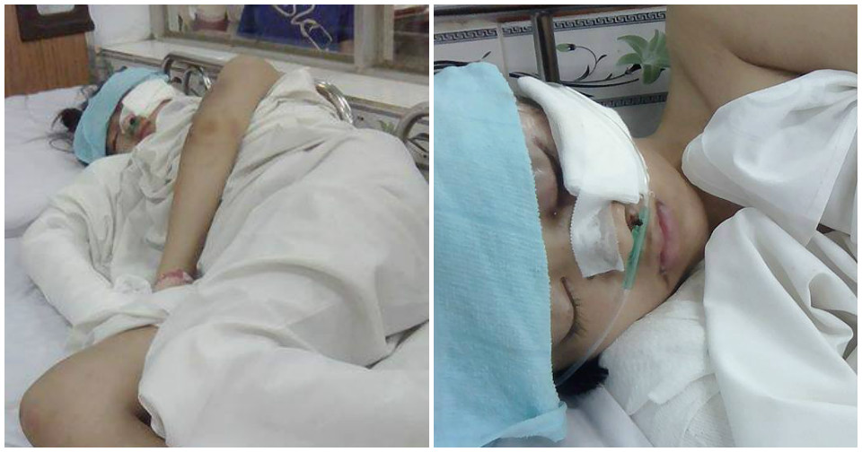 Bảo Lộc: Mong giúp đỡ em học sinh bị tai nạn giao thông nghiêm trọng trên đường đi học về