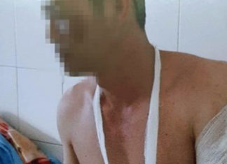 Đà Lạt: Chủ quán nhậu chém gần đứt lìa cánh tay chủ nợ