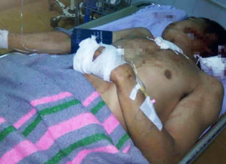 Bảo Lộc: Dùng gạch chắn ngang đường, còn vác dao chém hàng xóm trọng thương