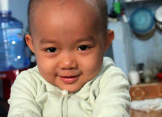 Lâm Đồng: Bé gái 3 tuổi bị ung thư buồng trứng cần giúp đỡ