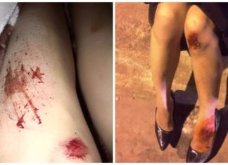 Thi công ẩu đường phục vụ Festival hoa Đà Lạt, nhiều người ngã xe