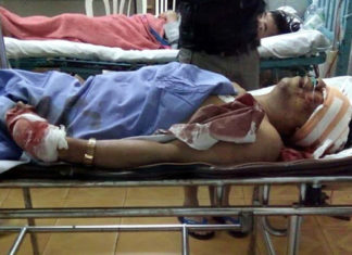 Bảo Lâm: Một thầy giáo bị chém lún sọ nguy kịch