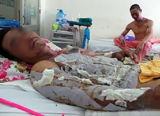 Lâm Đồng: Trượt chân, một nông dân bị lửa rẫy thiêu sống