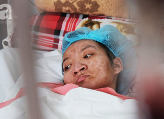 Lâm Đồng: Thương tâm cảnh thai phụ trẻ và người yêu bỏng nặng vì cháy nhà trước ngày cưới