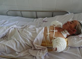 Lâm Đồng: Vợ nghẹn ngào ký giấy đồng ý đoạn chi 2 tay chồng vì điện giật