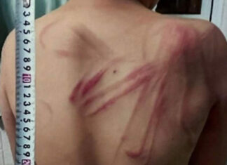 Đà Lạt: Khởi tố bị can vụ bạo hành dã man con trai