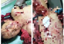 Lâm Đồng: Đốt pháo tự chế, 2 học sinh nguy kịch