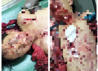 Lâm Đồng: Đốt pháo tự chế, 2 học sinh nguy kịch