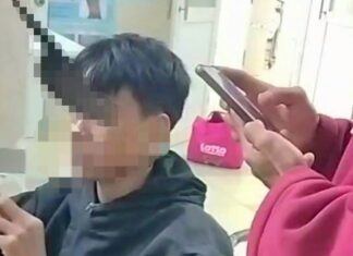 Di Linh: Thiếu niên 15 tuổi bị dao bầu cắm vào hốc mắt khi “biểu diễn” múa dao