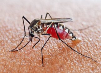 Dấu hiệu cho thấy sốt xuất huyết đã chuyển nặng, cần đi viện ngay